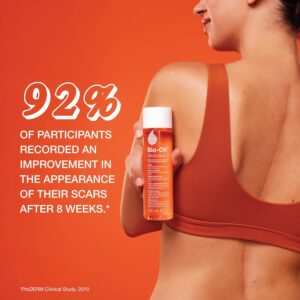 Bio-Oil Skincare Body Oil Serum – Vitamin E & A Moisturizer for Scars, Stretch Marks & Sensitive Skin – 2 Oz